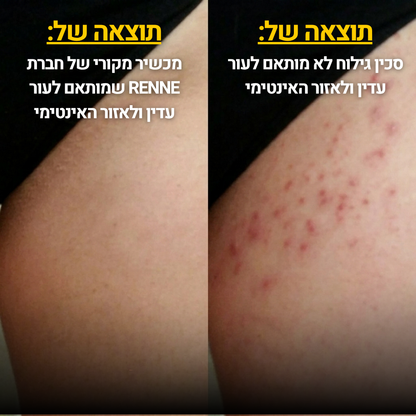 מסיר שיער | RENNE